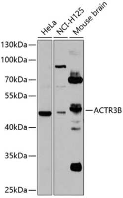 Western Blot: ACTR3B AntibodyBSA Free [NBP2-92520]