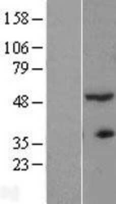 Western Blot: ACTR3B Overexpression Lysate [NBL1-07289]