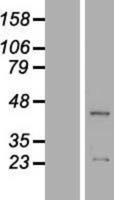 Western Blot: ACTR3B Overexpression Lysate [NBL1-07290]