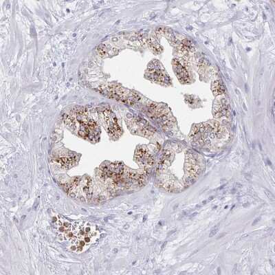 Immunohistochemistry: ACTR3C Antibody [NBP2-49206]