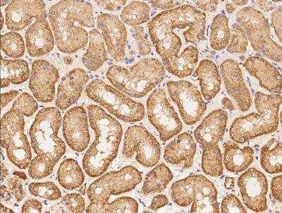 Immunohistochemistry-Paraffin: ACTR3C Antibody [NBP3-06502]