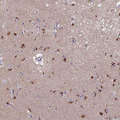 Immunohistochemistry: ACTR5 Antibody [NBP2-14524]