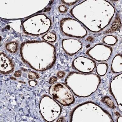 Immunohistochemistry-Paraffin: ACTR6 Antibody [NBP1-89001]