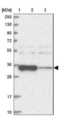 Western Blot: ACTR6 Antibody [NBP1-89000]