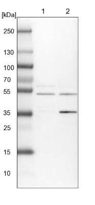 Western Blot: ACTR6 Antibody [NBP1-89000]