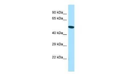 Western Blot: ACTR6 Antibody [NBP2-84392]