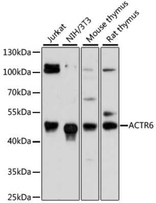 Western Blot: ACTR6 AntibodyAzide and BSA Free [NBP2-92112]