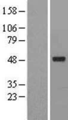 Western Blot: ACTR6 Overexpression Lysate [NBL1-07292]