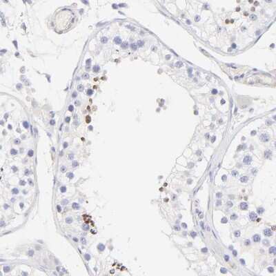 Immunohistochemistry-Paraffin: ACTRT1 Antibody [NBP1-89184]