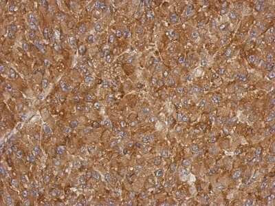Immunohistochemistry-Paraffin: ACTRT1 Antibody [NBP2-15278]