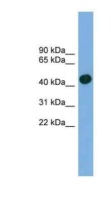 Western Blot: ACTRT1 Antibody [NBP1-56368]