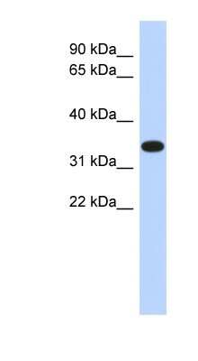 Western Blot: ACTRT1 Antibody [NBP1-56370]