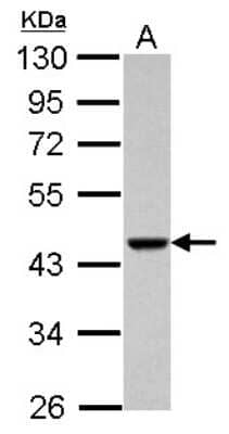 Western Blot: ACTRT1 Antibody [NBP2-15278]