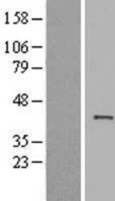 Western Blot: ACTRT1 Overexpression Lysate [NBL1-07293]