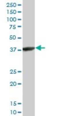 Western Blot: ACTRT2 Antibody (2E10) [H00140625-M03]