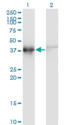 Western Blot: ACTRT2 Antibody (2E10) [H00140625-M03]