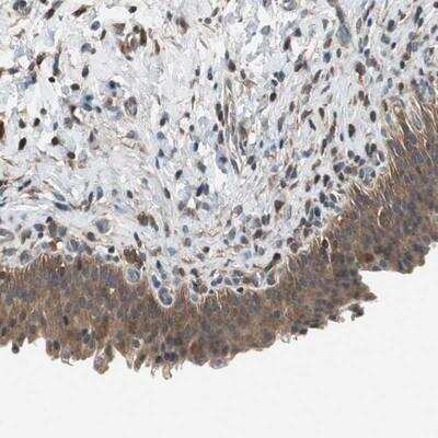 Immunohistochemistry: ACTRT2 Antibody [NBP1-89005]