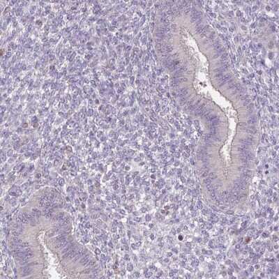 Immunohistochemistry-Paraffin: ACTRT2 Antibody [NBP1-89005]
