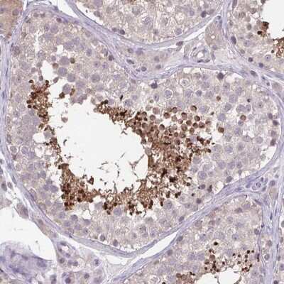Immunohistochemistry-Paraffin: ACTRT2 Antibody [NBP1-89005]