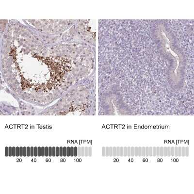 Immunohistochemistry-Paraffin: ACTRT2 Antibody [NBP1-89005]