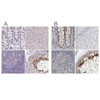 Immunohistochemistry-Paraffin: ACTRT2 Antibody [NBP1-89005]