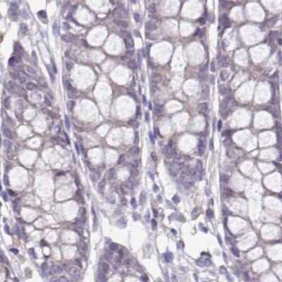 Immunohistochemistry-Paraffin: ACTRT2 Antibody [NBP1-89005]