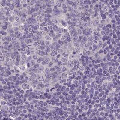 Immunohistochemistry-Paraffin: ACTRT2 Antibody [NBP1-89005]