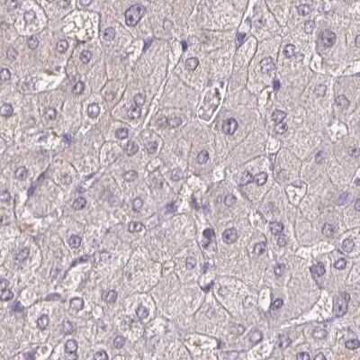 Immunohistochemistry-Paraffin: ACTRT2 Antibody [NBP1-89005]