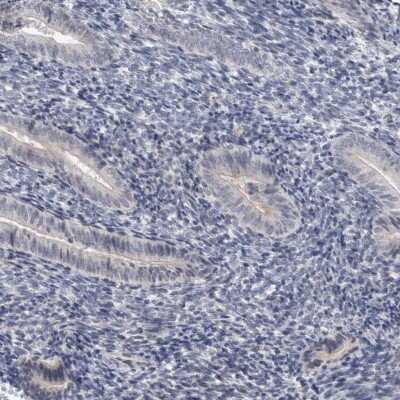 Immunohistochemistry-Paraffin: ACTRT2 Antibody [NBP1-89006]