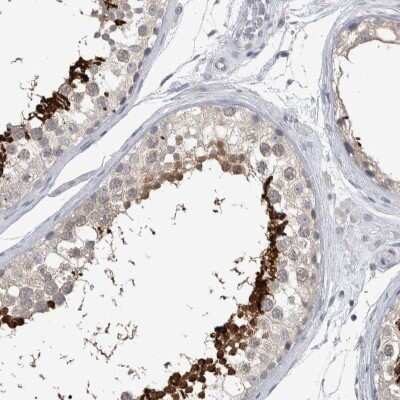 Immunohistochemistry-Paraffin: ACTRT2 Antibody [NBP1-89006]