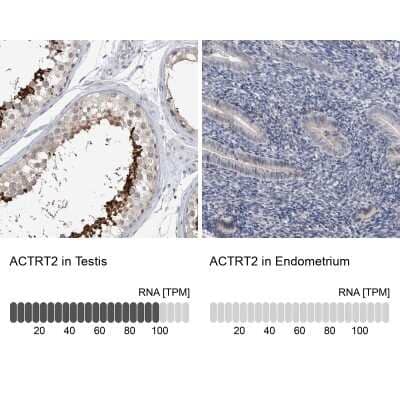 Immunohistochemistry-Paraffin: ACTRT2 Antibody [NBP1-89006]