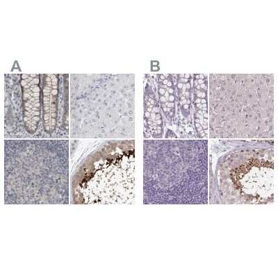 Immunohistochemistry-Paraffin: ACTRT2 Antibody [NBP1-89006]