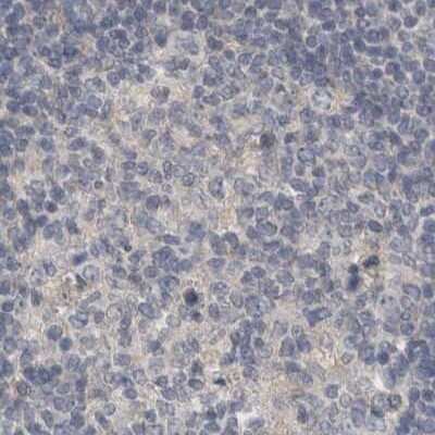 Immunohistochemistry-Paraffin: ACTRT2 Antibody [NBP1-89006]