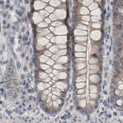 Immunohistochemistry-Paraffin: ACTRT2 Antibody [NBP1-89006]