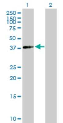 Western Blot: ACTRT2 Antibody [H00140625-B01P]