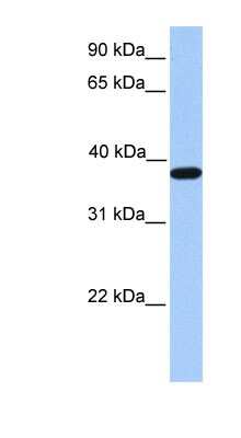 Western Blot: ACTRT2 Antibody [NBP1-54626]