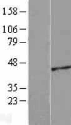 Western Blot: ACTRT2 Overexpression Lysate [NBL1-07294]