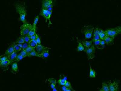 Immunocytochemistry/ Immunofluorescence: ACY3 Antibody [NBP2-99167]