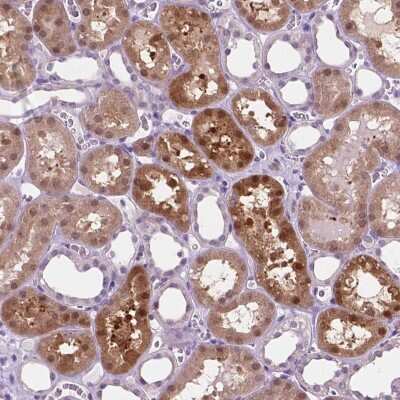 Immunohistochemistry: ACY3 Antibody [NBP2-48895]