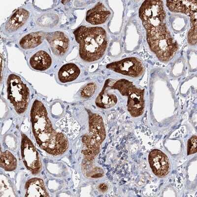 Immunohistochemistry-Paraffin: ACY3 Antibody [NBP1-89256]