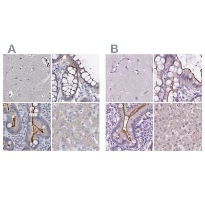 Immunohistochemistry-Paraffin: ACY3 Antibody [NBP1-89256]