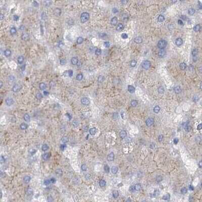 Immunohistochemistry-Paraffin: ACY3 Antibody [NBP1-89256]