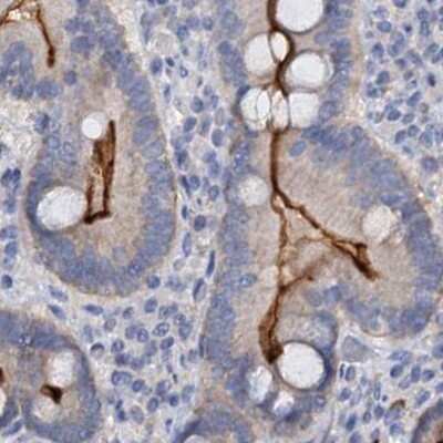 Immunohistochemistry-Paraffin: ACY3 Antibody [NBP1-89256]