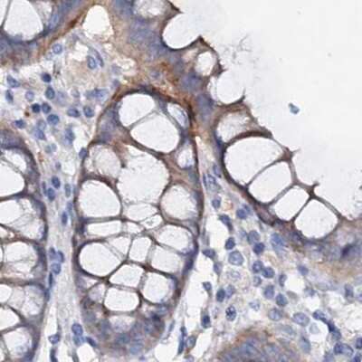 Immunohistochemistry-Paraffin: ACY3 Antibody [NBP1-89256]