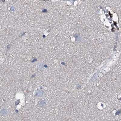 Immunohistochemistry-Paraffin: ACY3 Antibody [NBP1-89256]