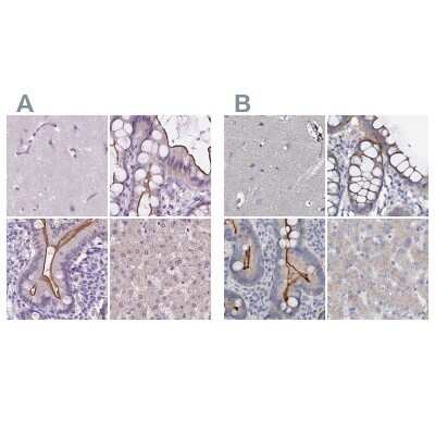 Immunohistochemistry-Paraffin: ACY3 Antibody [NBP2-48895]