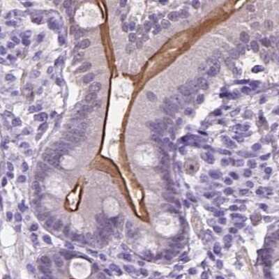 Immunohistochemistry-Paraffin: ACY3 Antibody [NBP2-48895]