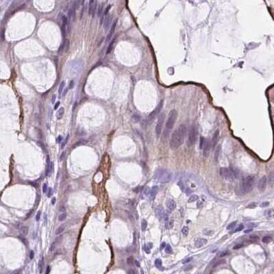 Immunohistochemistry-Paraffin: ACY3 Antibody [NBP2-48895]