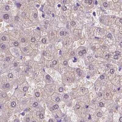 Immunohistochemistry-Paraffin: ACY3 Antibody [NBP2-48895]