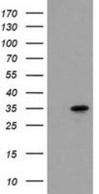 Western Blot: ACY3 Antibody (OTI2D5)Azide and BSA Free [NBP2-72329]